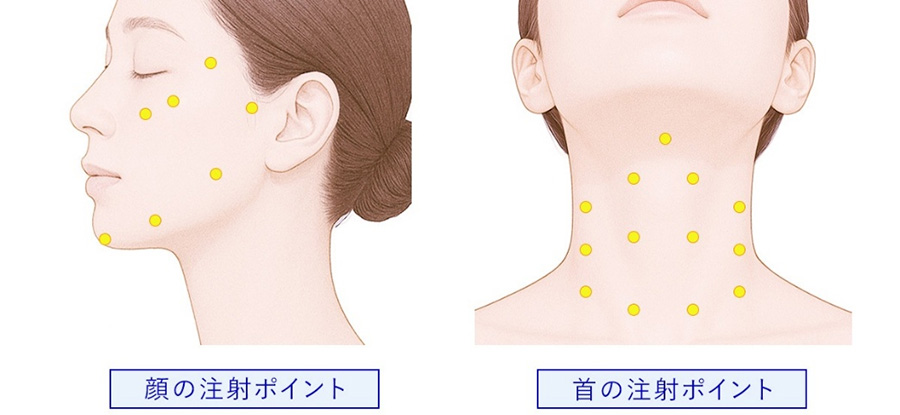 注入部位画像